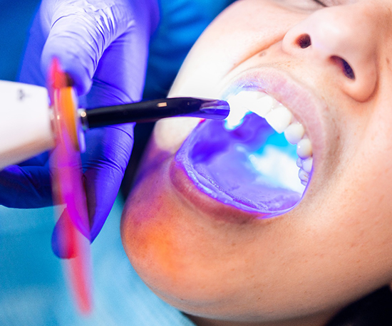 a dentist shining a UV light on a tooth