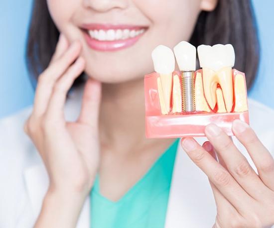 a person holding a model of a dental implant