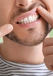 man pointing to inflamed gums