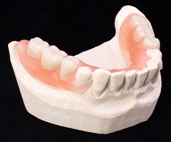 Model smile with partial denture