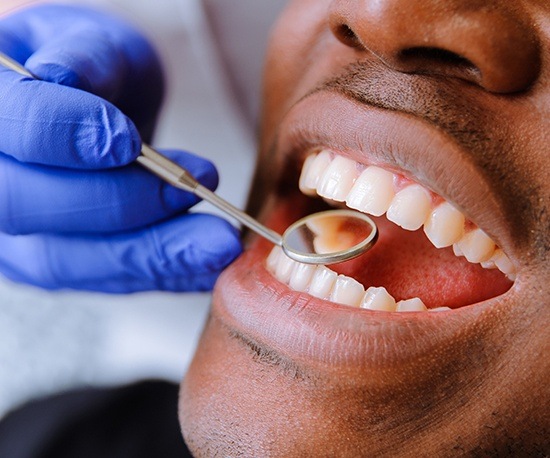 Man receiving dental exam