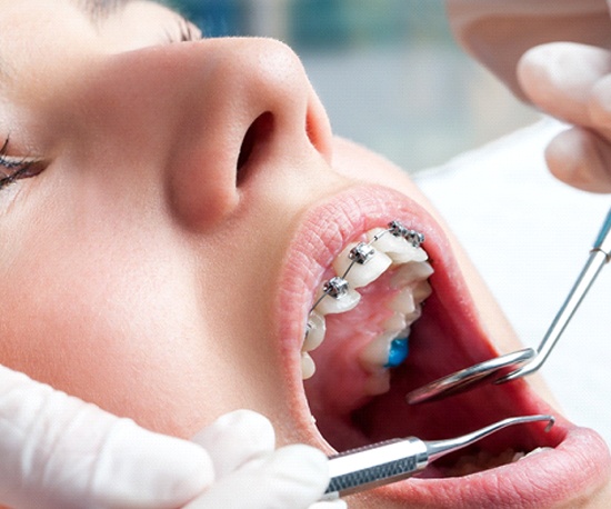 Patient visiting her dentist for orthodontic checkup for braces in Murphy