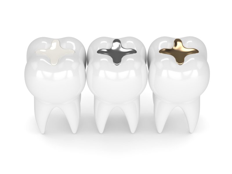 3-D diagram of dental fillings