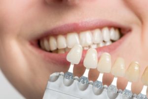 an enamel shade chart in front of a person's smile